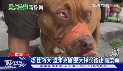 心疼!惡犬攻擊2歲女童 緊咬不放全身40處咬痕｜TVBS新聞